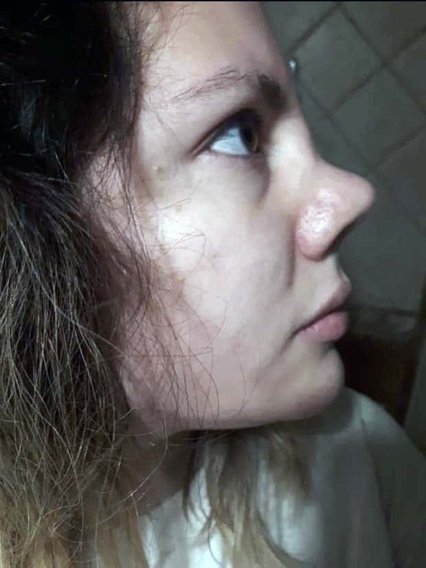 Unfortunate Cosmetic Enhancement Failures (31 photos)