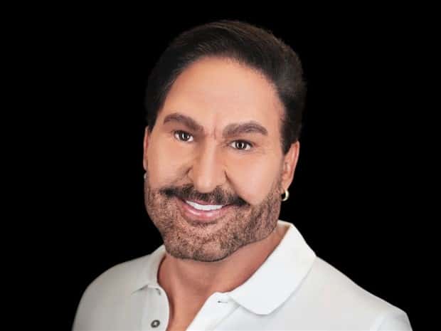 Unfortunate Cosmetic Enhancement Failures (31 photos)