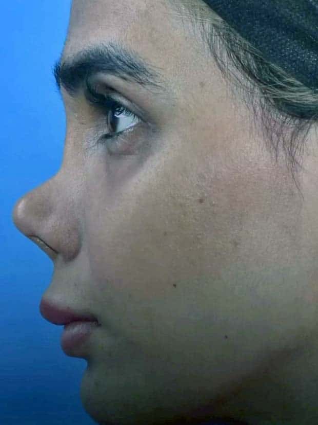 Unfortunate Cosmetic Enhancement Failures (31 photos)