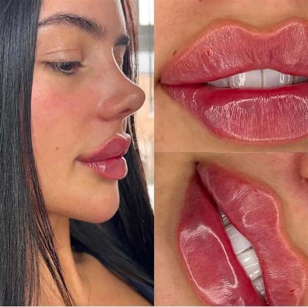 Unfortunate Cosmetic Enhancement Failures (31 photos)