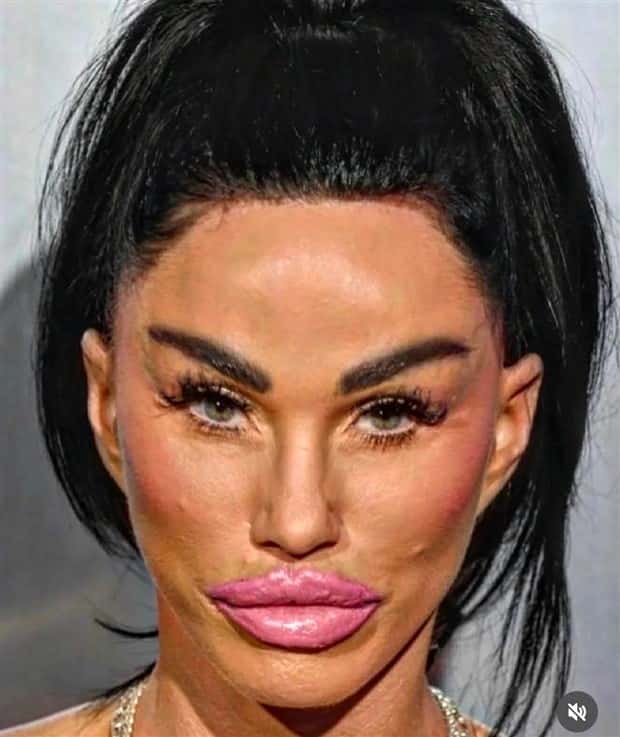 Unfortunate Cosmetic Enhancement Failures (31 photos)