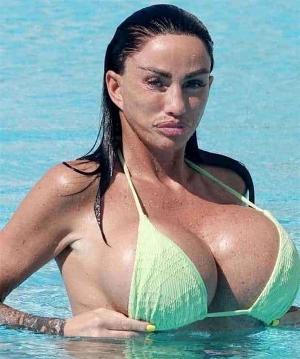 Unfortunate Cosmetic Enhancement Failures (31 photos)