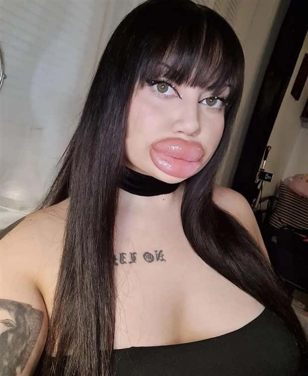 Unfortunate Cosmetic Enhancement Failures (31 photos)