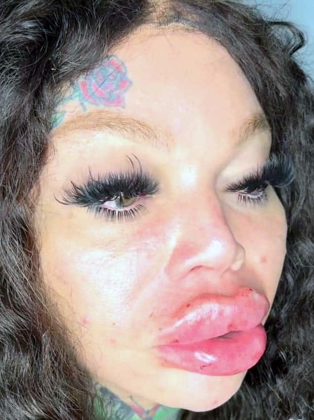 Unfortunate Cosmetic Enhancement Failures (31 photos)