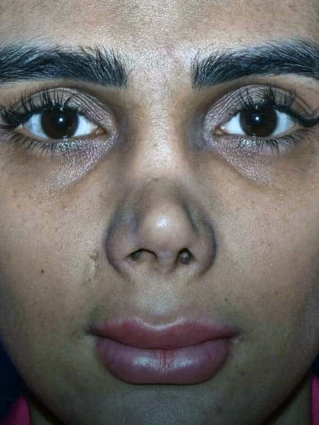 Unfortunate Cosmetic Enhancement Failures (31 photos)