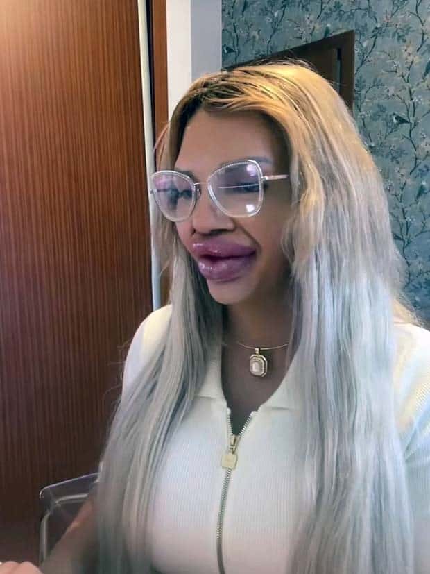 Unfortunate Cosmetic Enhancement Failures (31 photos)