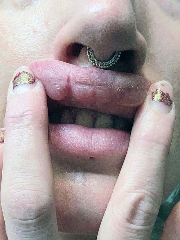 Unfortunate Cosmetic Enhancement Failures (31 photos)