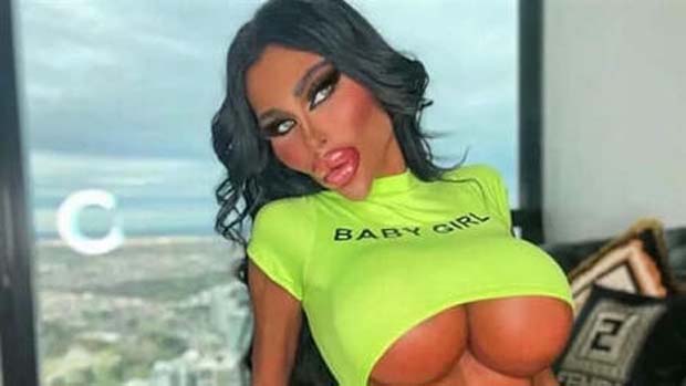 Unfortunate Cosmetic Enhancement Failures (31 photos)