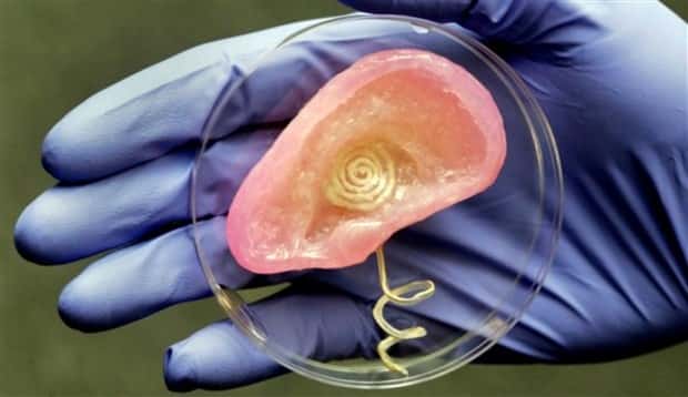 3D Printed Human Body Parts Are Reality (26 photos)