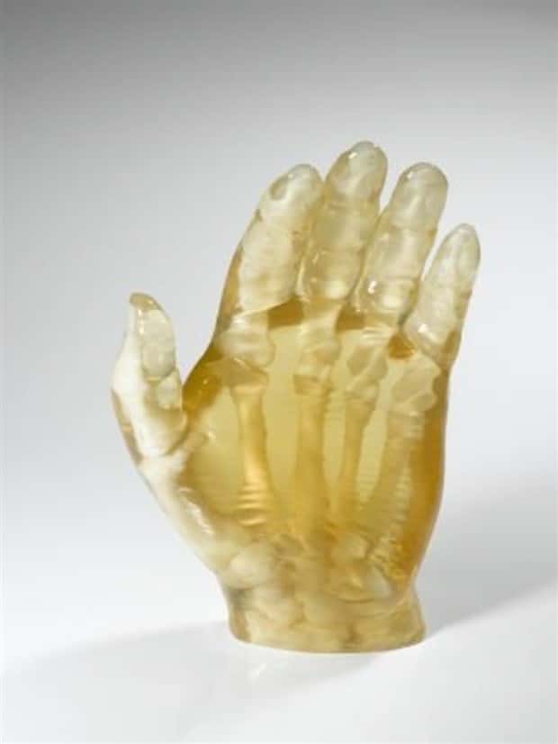 3D Printed Human Body Parts Are Reality (26 photos)
