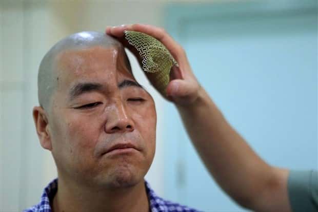 3D Printed Human Body Parts Are Reality (26 photos)
