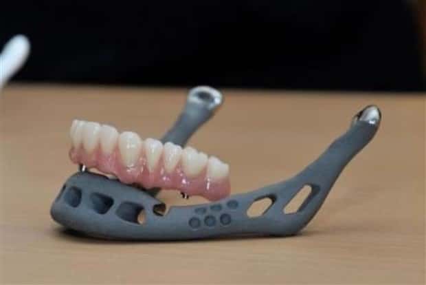 3D Printed Human Body Parts Are Reality (26 photos)