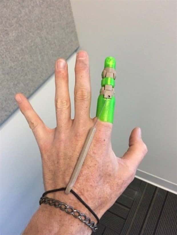 3D Printed Human Body Parts Are Reality (26 photos)