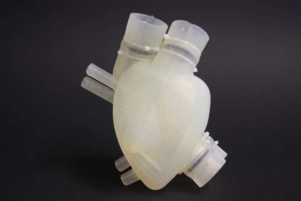 3D Printed Human Body Parts Are Reality (26 photos)