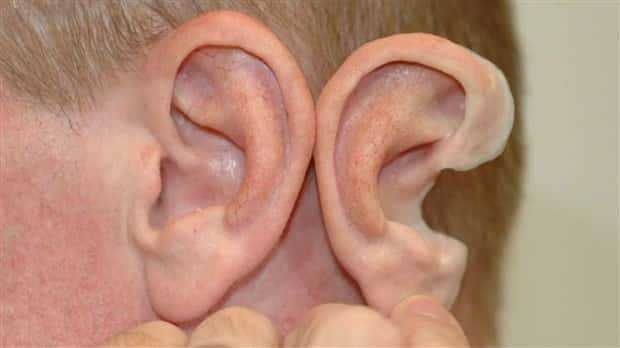 3D Printed Human Body Parts Are Reality (26 photos)