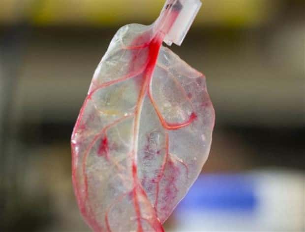 3D Printed Human Body Parts Are Reality (26 photos)