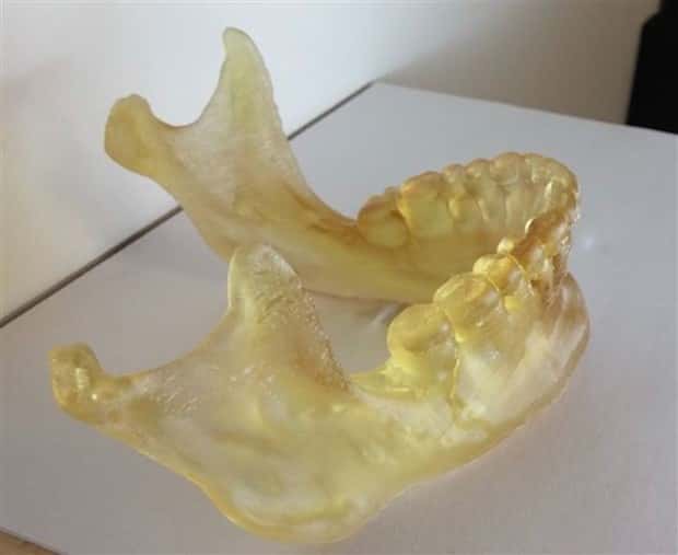3D Printed Human Body Parts Are Reality (26 photos)