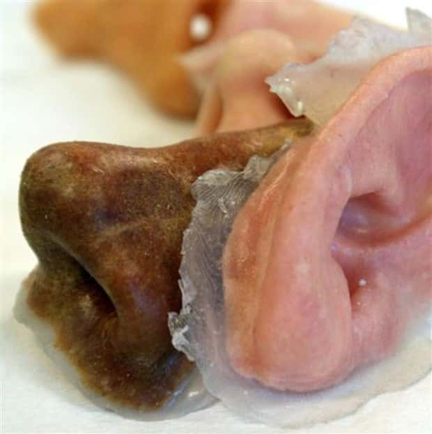 3D Printed Human Body Parts Are Reality (26 photos)