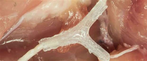 3D Printed Human Body Parts Are Reality (26 photos)