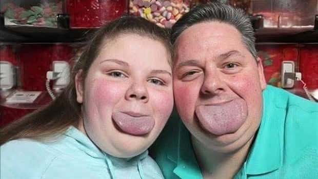 Byron Schlenker widest tongue 8 This Dad and His Daughter Have Tongues That Stun (11 photos)