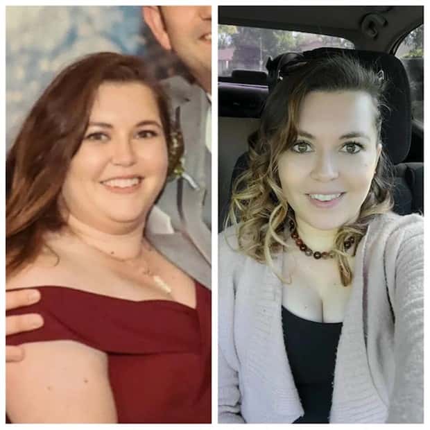 Weight Loss Is Possible #5 (25 photos)