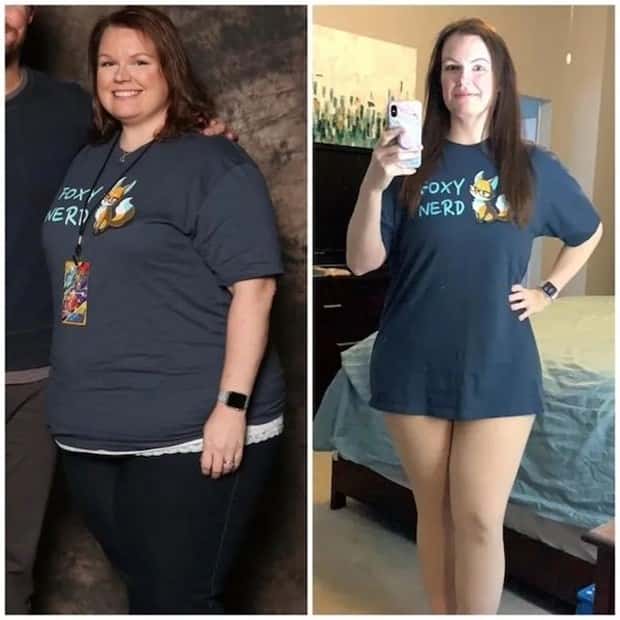 Weight Loss Is Possible #5 (25 photos)