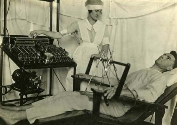 Creepy Medical Devices of the Past (23 photos)