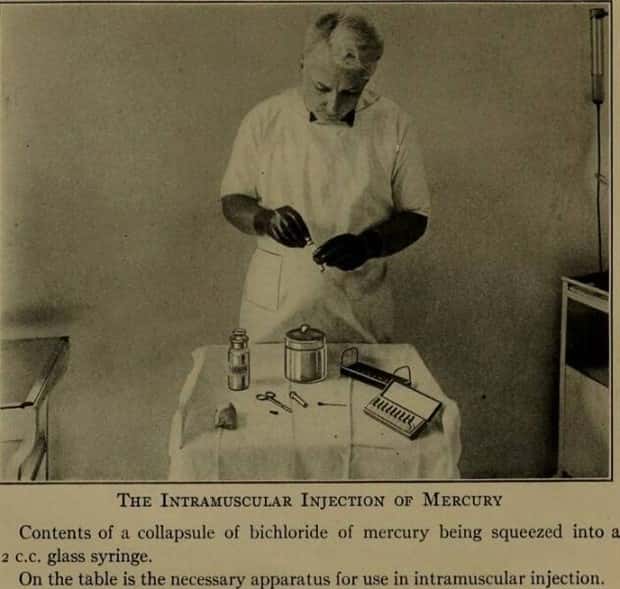Creepy Medical Devices of the Past (23 photos)