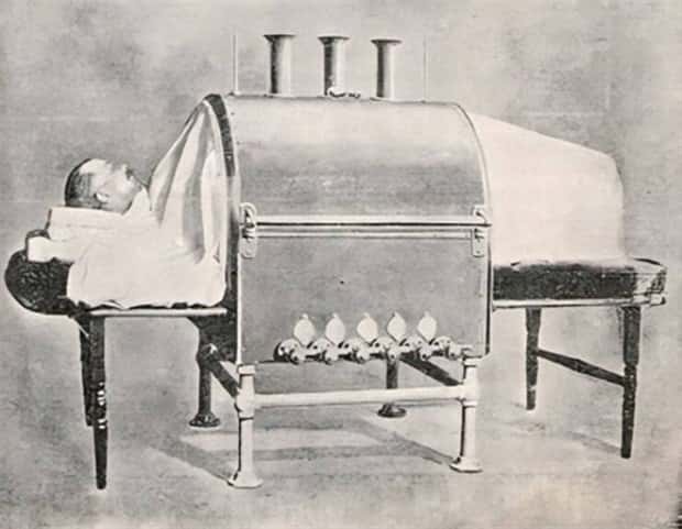Creepy Medical Devices of the Past (23 photos)