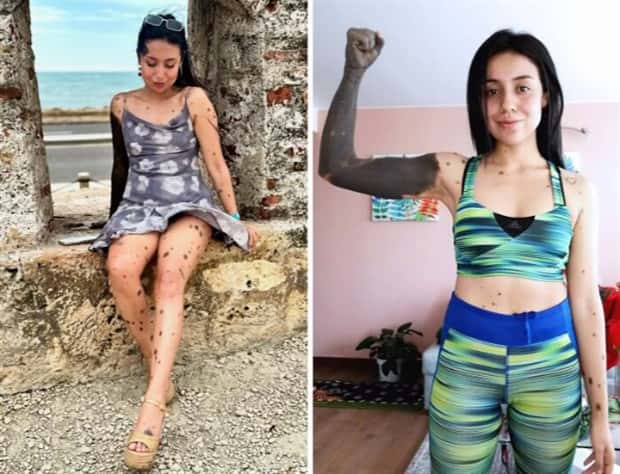 28 People Flaunting Their Cool Birthmarks (28 photos)