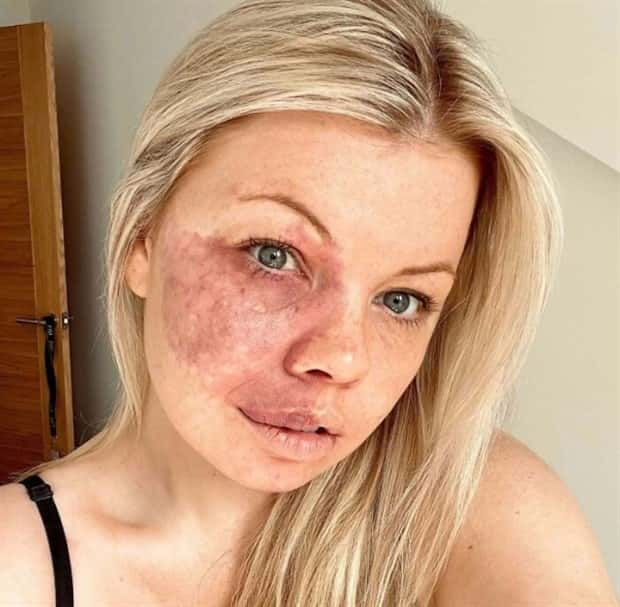 28 People Flaunting Their Cool Birthmarks (28 photos)