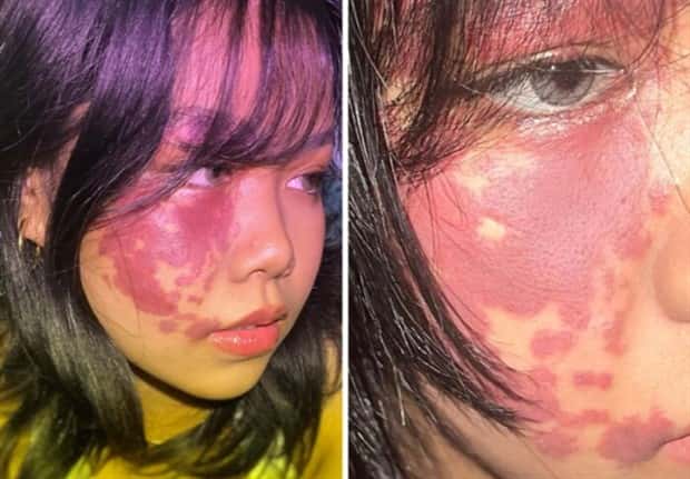 28 People Flaunting Their Cool Birthmarks (28 photos)
