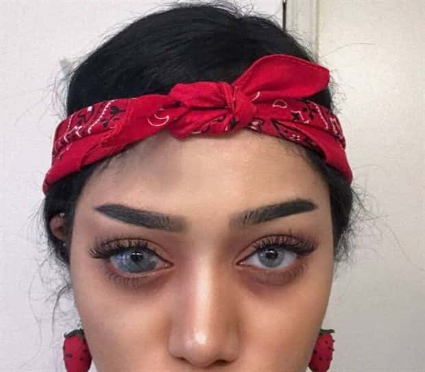 28 People Flaunting Their Cool Birthmarks (28 photos)