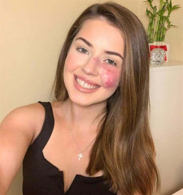 28 People Flaunting Their Cool Birthmarks (28 photos)