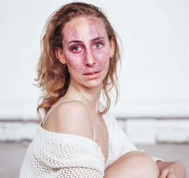 28 People Flaunting Their Cool Birthmarks (28 photos)