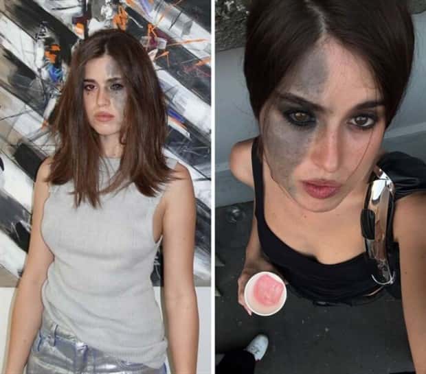 28 People Flaunting Their Cool Birthmarks (28 photos)