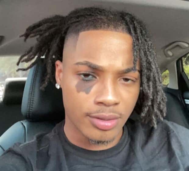 28 People Flaunting Their Cool Birthmarks (28 photos)