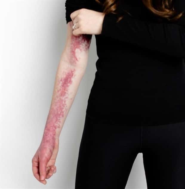 28 People Flaunting Their Cool Birthmarks (28 photos)