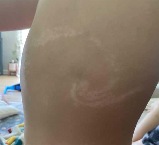 28 People Flaunting Their Cool Birthmarks (28 photos)