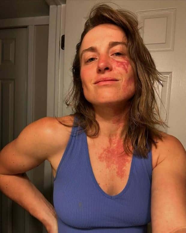 28 People Flaunting Their Cool Birthmarks (28 photos)