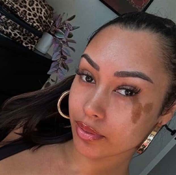 28 People Flaunting Their Cool Birthmarks (28 photos)