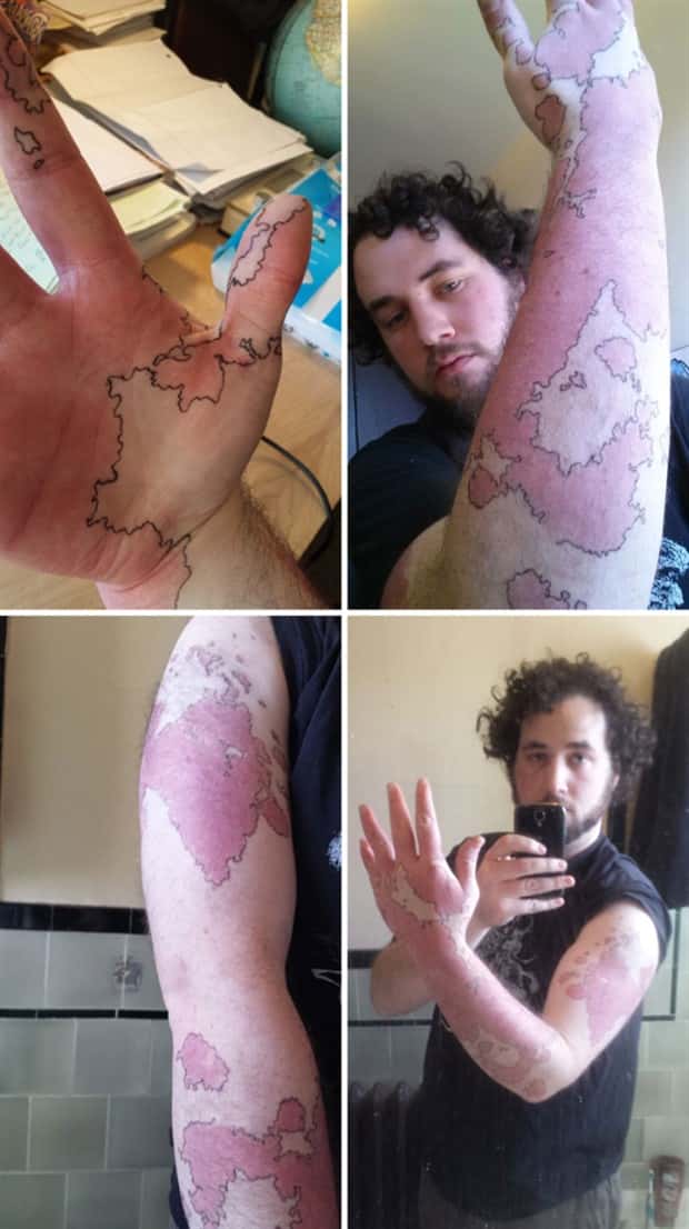 28 People Flaunting Their Cool Birthmarks (28 photos)