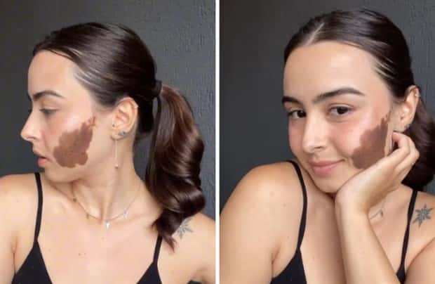 28 People Flaunting Their Cool Birthmarks (28 photos)