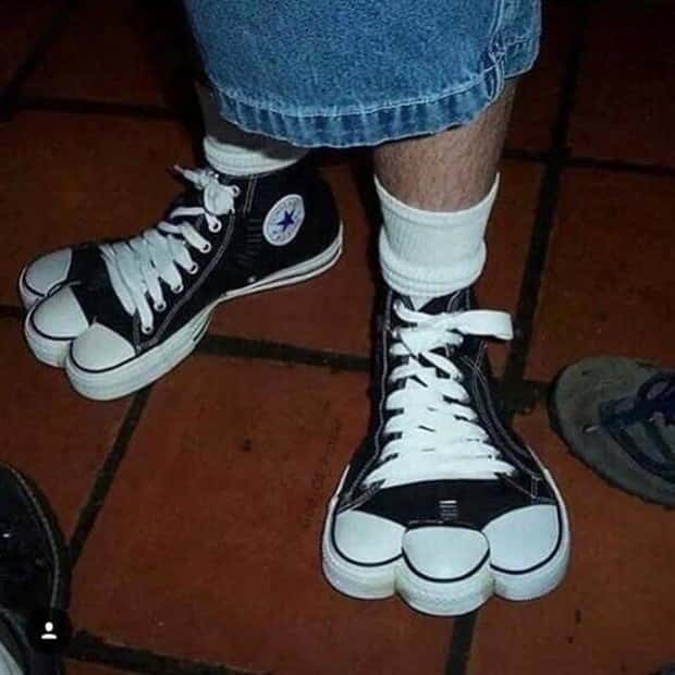 Terrible Footwear That Sparks Instant Cringe (21 photos)