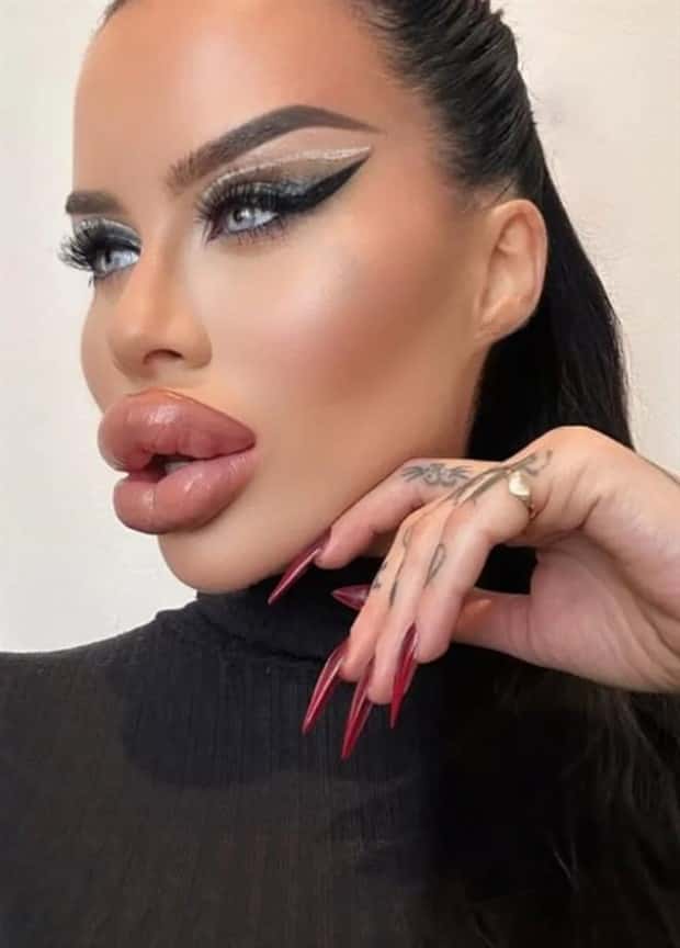 Fetisch Barbie Pushes Limits of Fillers (11 photos)