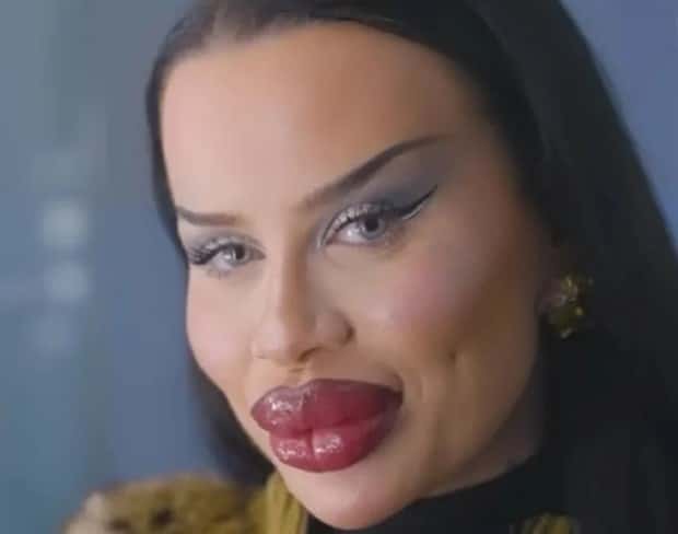 Fetisch Barbie Pushes Limits of Fillers (11 photos)