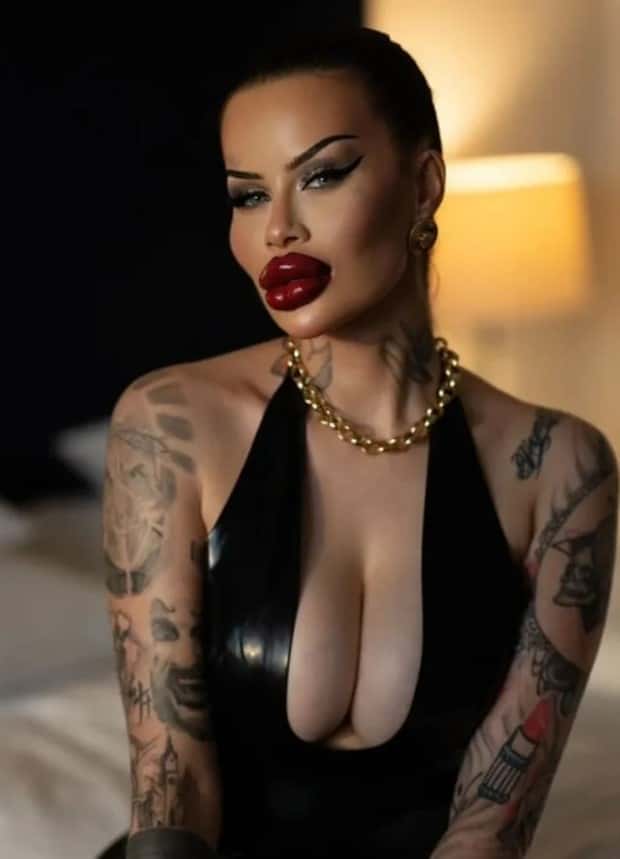 Fetisch Barbie Pushes Limits of Fillers (11 photos)