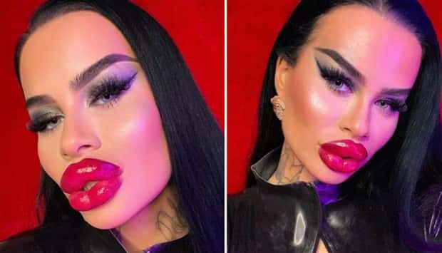 Fetisch Barbie Pushes Limits of Fillers (11 photos)