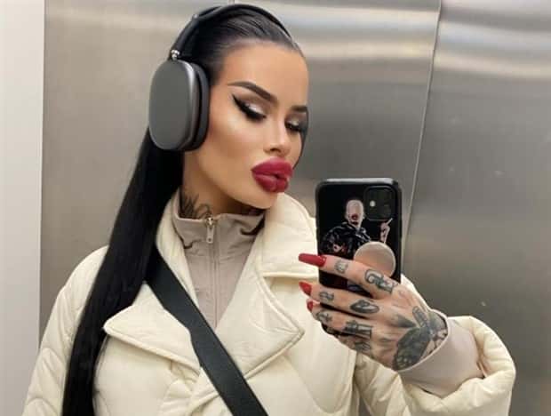 Fetisch Barbie Pushes Limits of Fillers (11 photos)