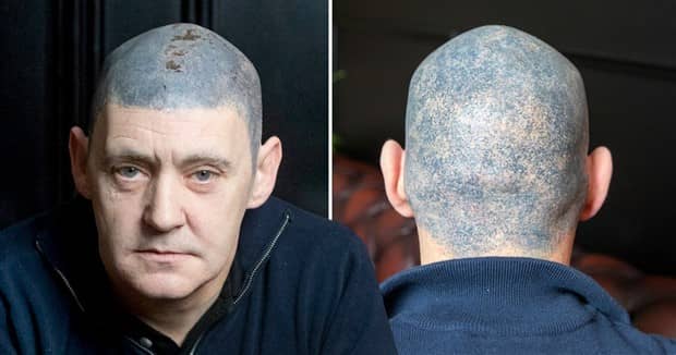 Hair Tattoos That Made It Worse (17 photos)